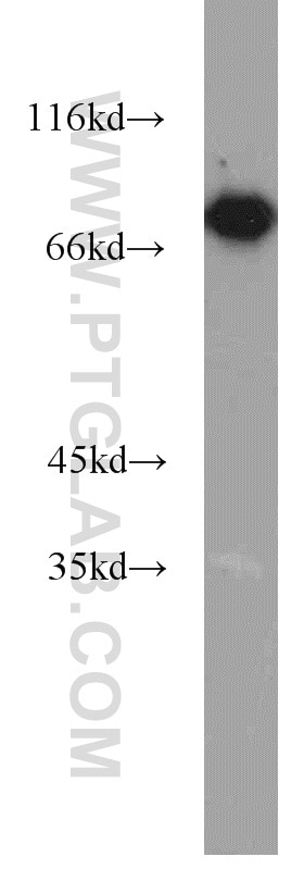 Western Blot (WB) analysis of mouse pancreas tissue using HRD1/SYVN1 Polyclonal antibody (13473-1-AP)