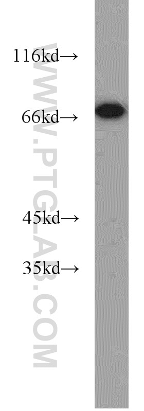 Western Blot (WB) analysis of MDA-MB-453s cells using HRD1/SYVN1 Polyclonal antibody (13473-1-AP)