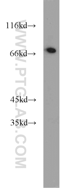 WB analysis of mouse ovary using 13473-1-AP