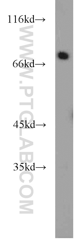 Western Blot (WB) analysis of mouse kidney tissue using HRD1/SYVN1 Polyclonal antibody (13473-1-AP)