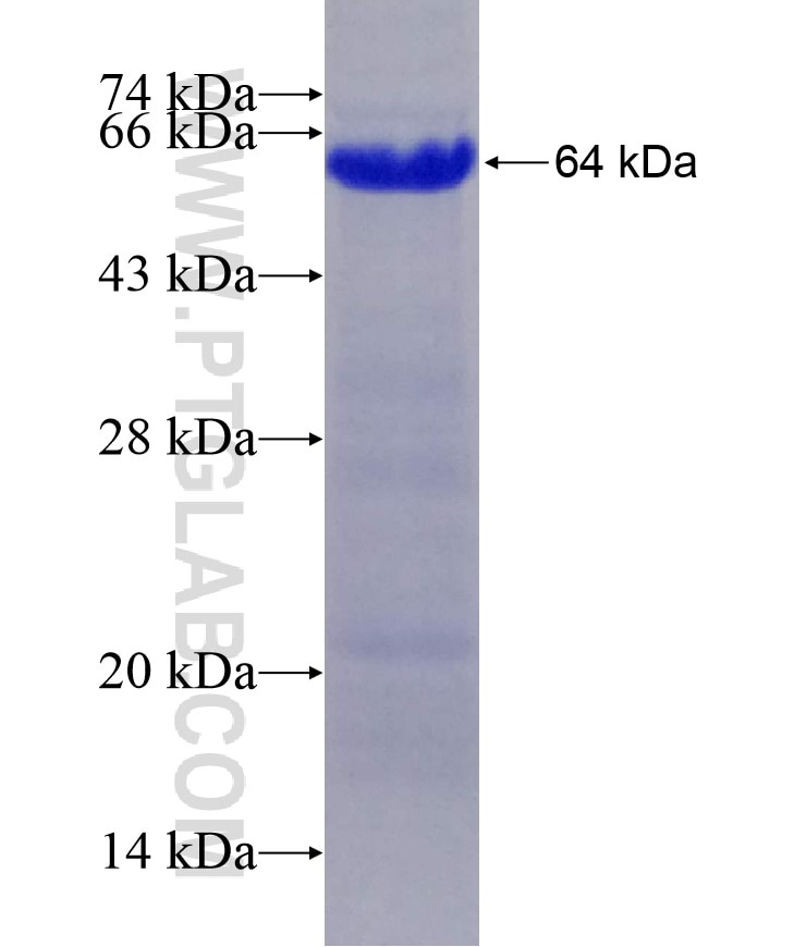 HRD1 fusion protein Ag4456 SDS-PAGE