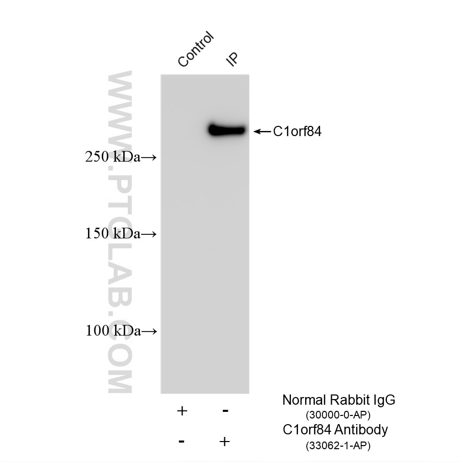 Immunoprecipitation (IP) experiment of HL-60 cells using SZT2 Polyclonal antibody (33062-1-AP)