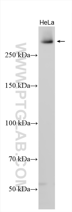 Western Blot (WB) analysis of various lysates using SZT2 Polyclonal antibody (33062-1-AP)