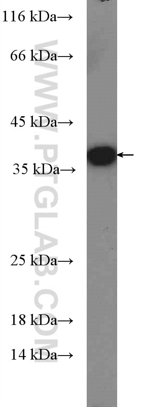 Western Blot (WB) analysis of Recombinant protein using Sa Cas9 Polyclonal antibody (26927-1-AP)
