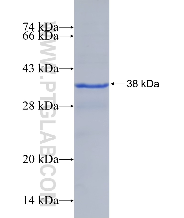 Sa Cas9 fusion protein Ag25669 SDS-PAGE