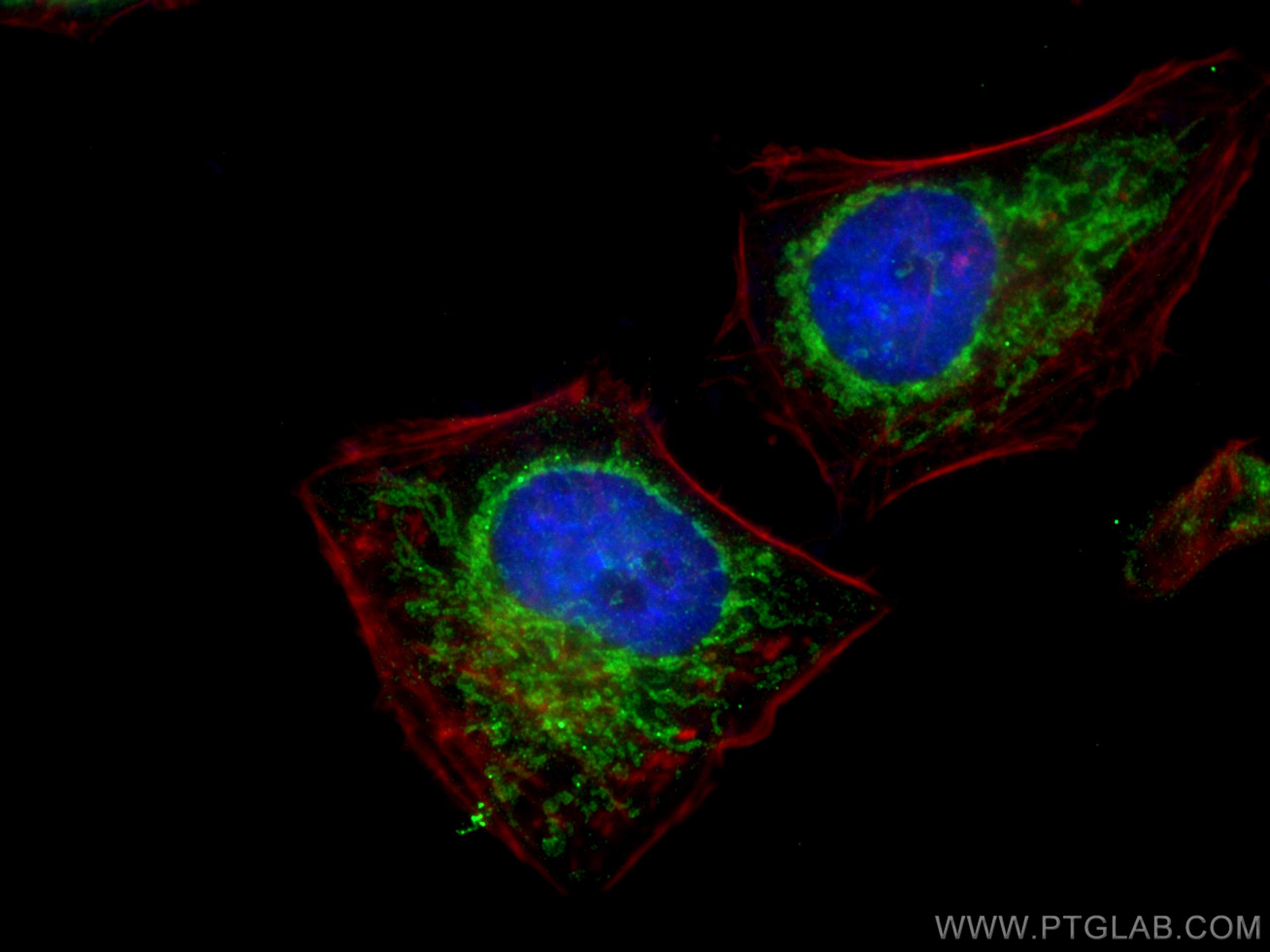 Immunofluorescence (IF) / fluorescent staining of HeLa cells using Sam50 Polyclonal antibody (28679-1-AP)