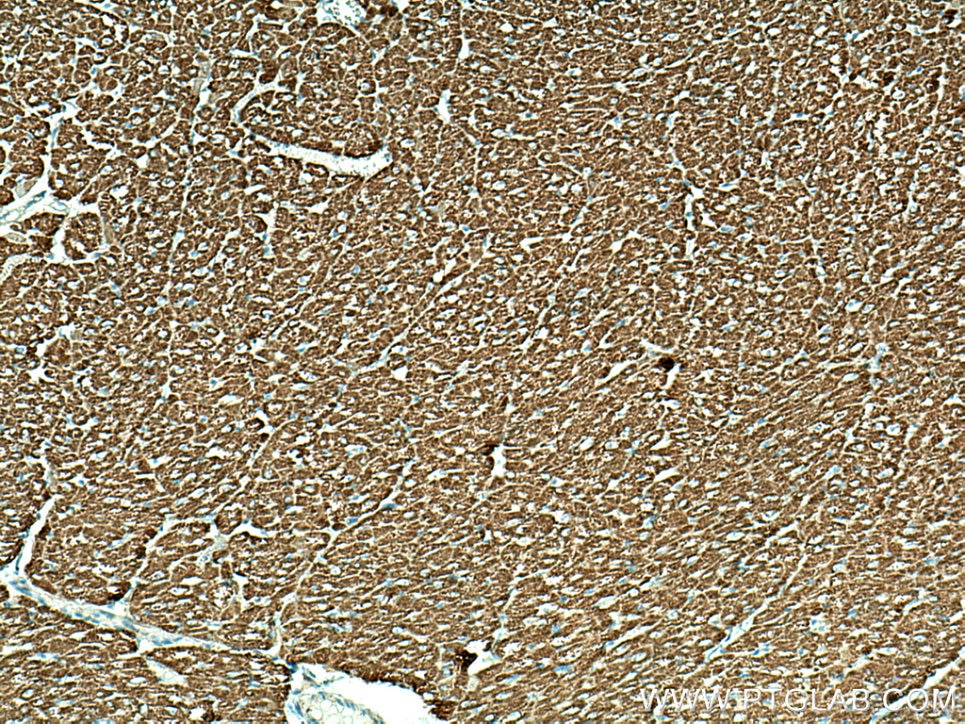 Immunohistochemistry (IHC) staining of human heart tissue using Sam50 Polyclonal antibody (28679-1-AP)