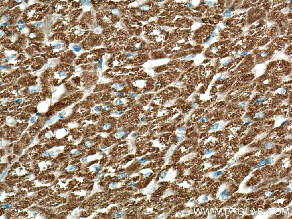 Immunohistochemistry (IHC) staining of human heart tissue using Sam50 Polyclonal antibody (28679-1-AP)