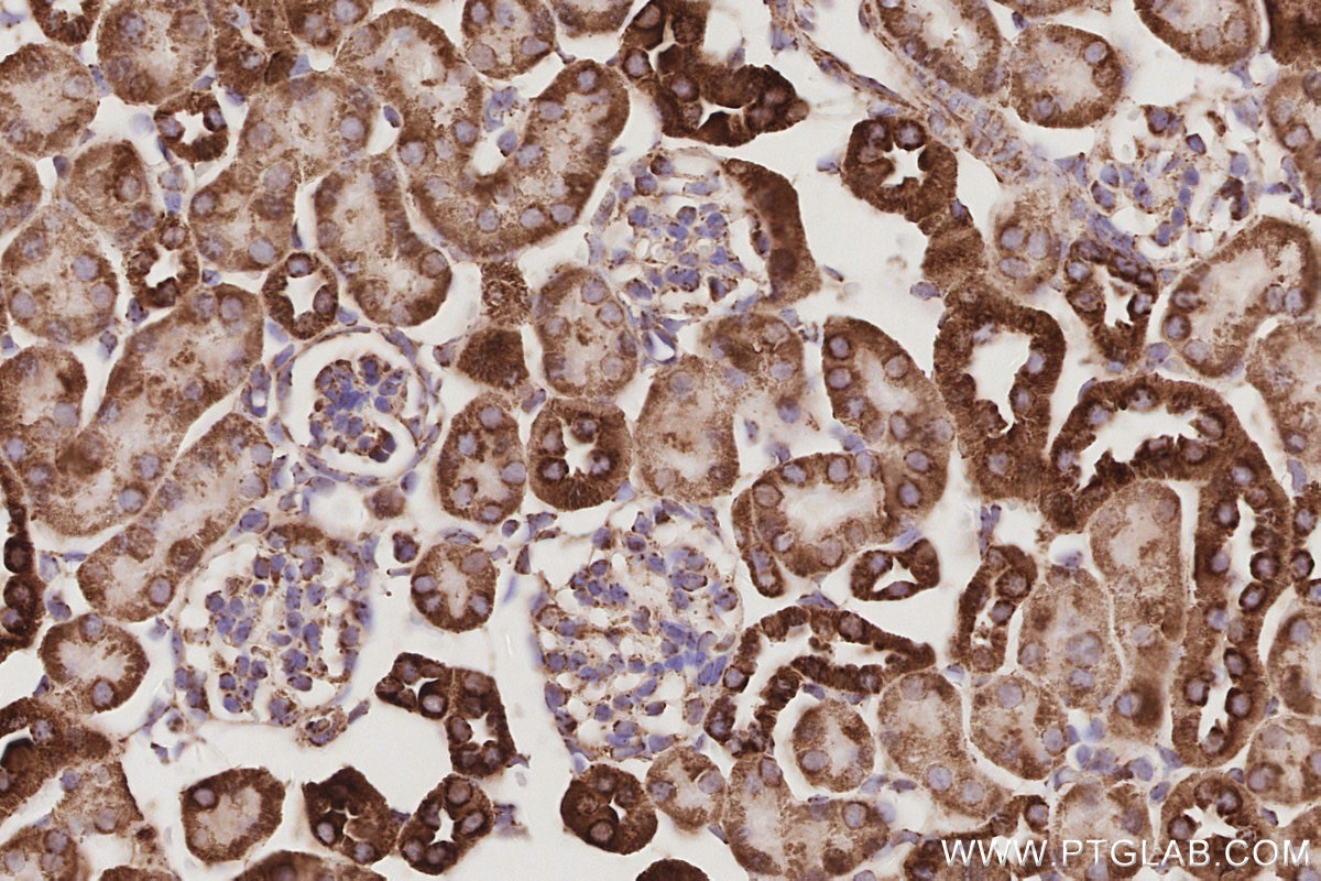 Immunohistochemistry (IHC) staining of mouse kidney tissue using Sam50 Polyclonal antibody (28679-1-AP)