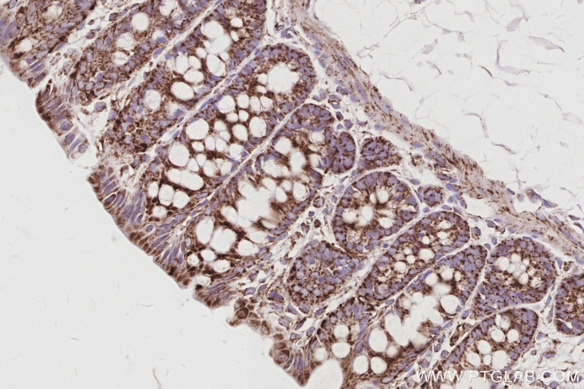 Immunohistochemistry (IHC) staining of rat colon tissue using Sam50 Polyclonal antibody (28679-1-AP)