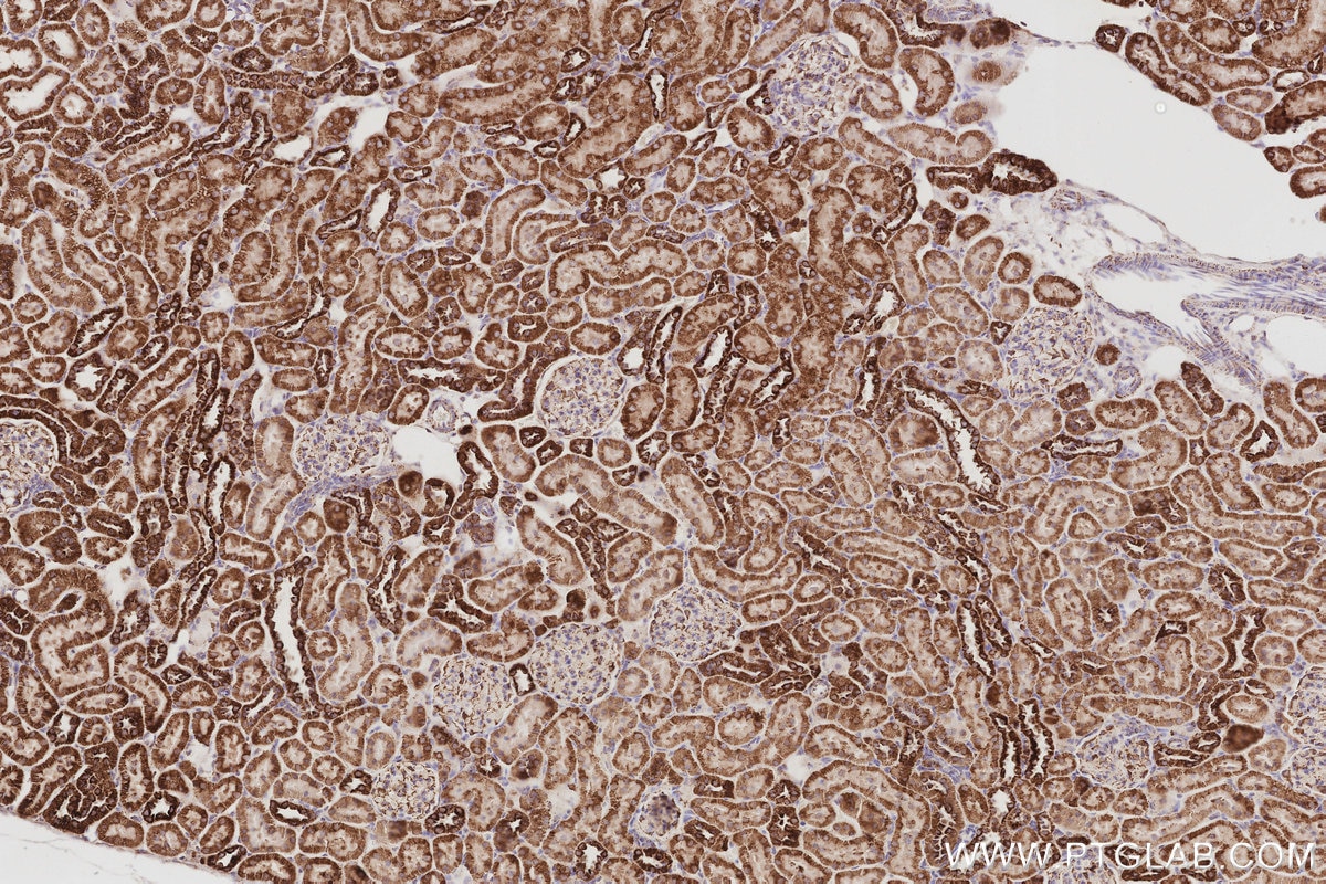 Immunohistochemistry (IHC) staining of rat kidney tissue using Sam50 Polyclonal antibody (28679-1-AP)