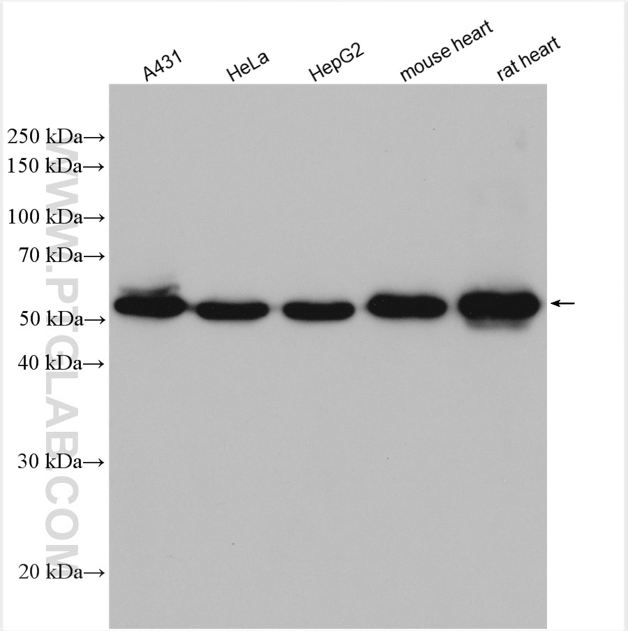 Western Blot (WB) analysis of various lysates using Sam50 Polyclonal antibody (28679-1-AP)