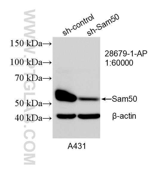 Western Blot (WB) analysis of A431 cells using Sam50 Polyclonal antibody (28679-1-AP)