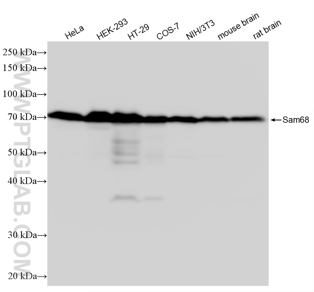 Western Blot (WB) analysis of various lysates using Sam68 Recombinant monoclonal antibody (88301-1-RR)