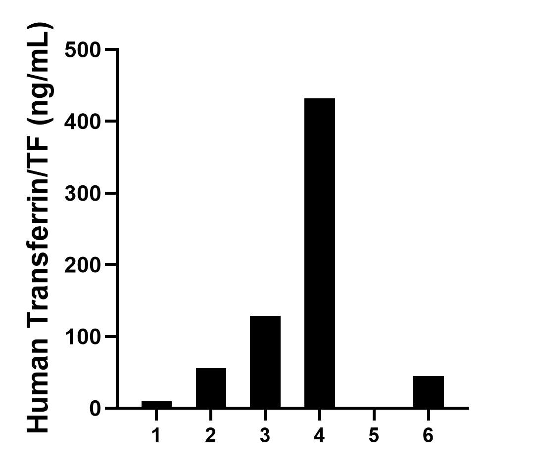 Urine of six individual healthy human donors was measured. The Transferrin/TF concentration of detected samples was determined to be 111.7 ng/mL with a range of 0.7-431.6 ng/mL.