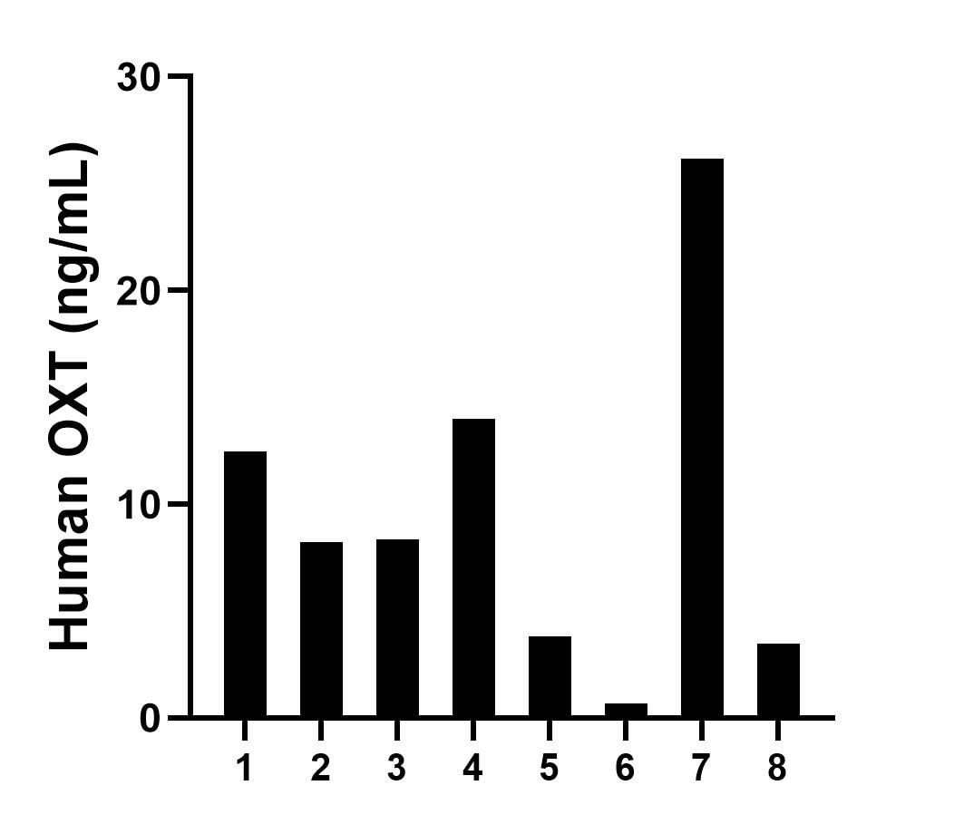 Serum of eight individual healthy human donors was measured. The OXT concentration of detected samples was determined to be 9.7 ng/mL with a range of 0.7-26.2 ng/mL.	