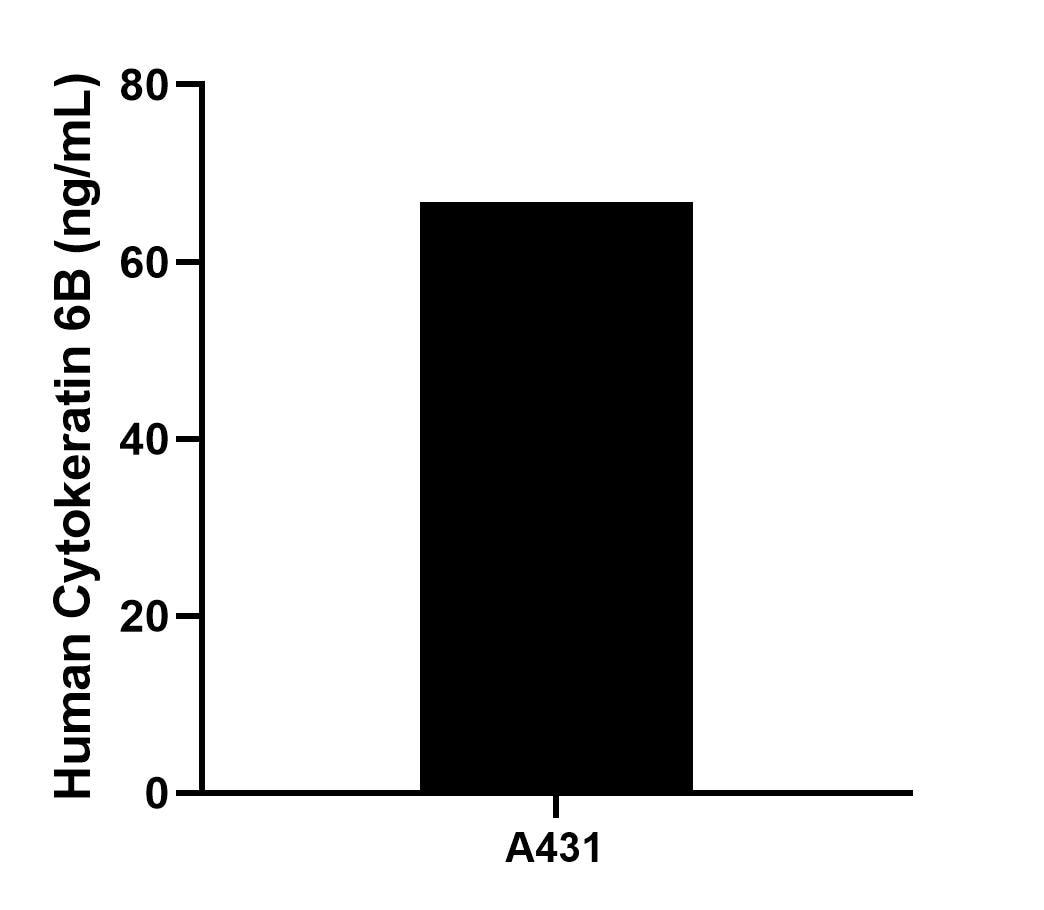 The mean Cytokeratin 6B concentration was determined to be 66.72 ng/mL in A431 cell extract based on a 3.70 mg/mL extract load.
