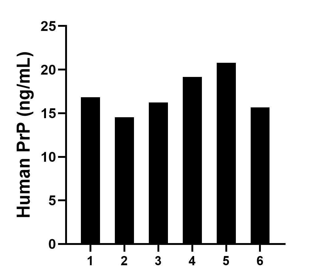 Serum of six individual healthy human donors was measured. The PrP concentration of detected samples was determined to be 17.2 ng/mL with a range of 14.5-20.8 ng/mL.	