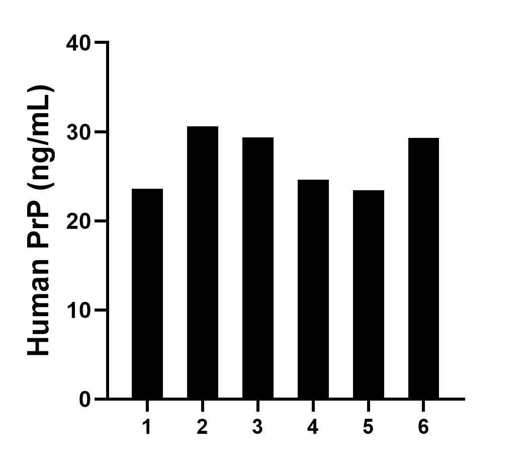 Cerebrospinal fluid of six individual human donors was measured. The PrP concentration of detected samples was determined to be 26.8 ng/mL with a range of 23.4-30.6 ng/mL.	