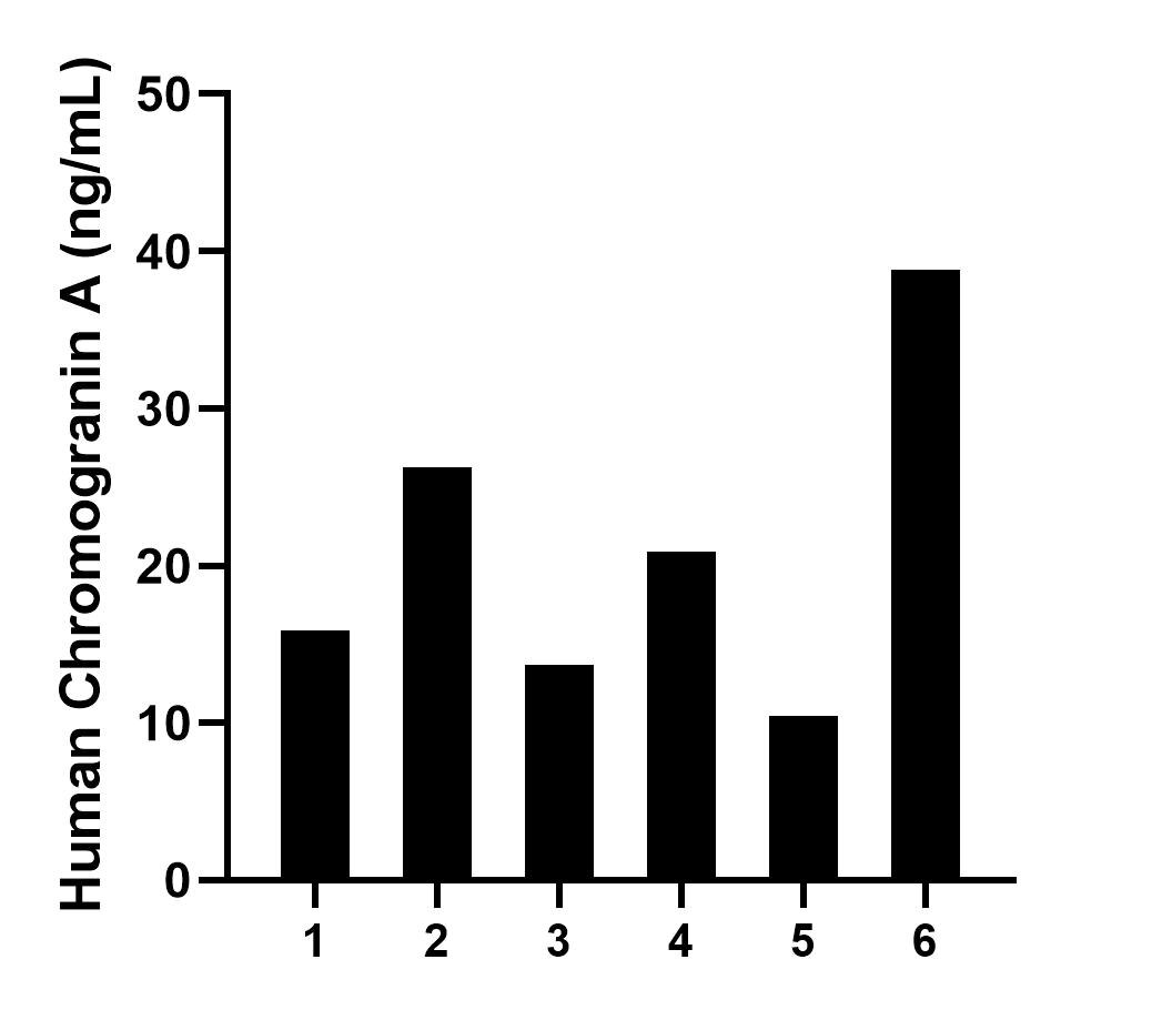 Serum of six individual healthy human donors was measured. The Chromogranin A concentration of detected samples was determined to be 21.01 ng/mL with a range of 10.47-38.83 ng/mL.	