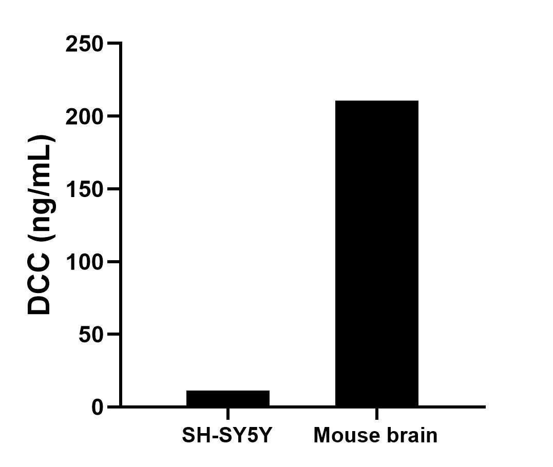 The mean DCC concentration was determined to be 11.21 ng/mL in SH-SY5Y cell extract based on a 1.00 mg/mL extract load and 210.63 ng/mL in mouse brain tissue extract based on a 6.60 mg/mL extract load. 