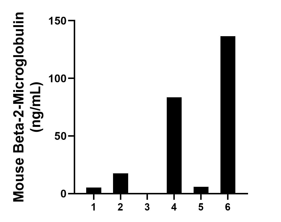 Urine of six mice was measured. The mouse Beta-2-Microglobulin concentration of detected samples was determined to be 49.78 ng/mL with a range of ND - 136.66 ng/mL.