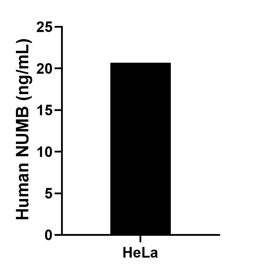 The mean NUMB concentration was determined to be 20.70 ng/mL in HeLa cell extract based on a 1.30 mg/mL extract load.