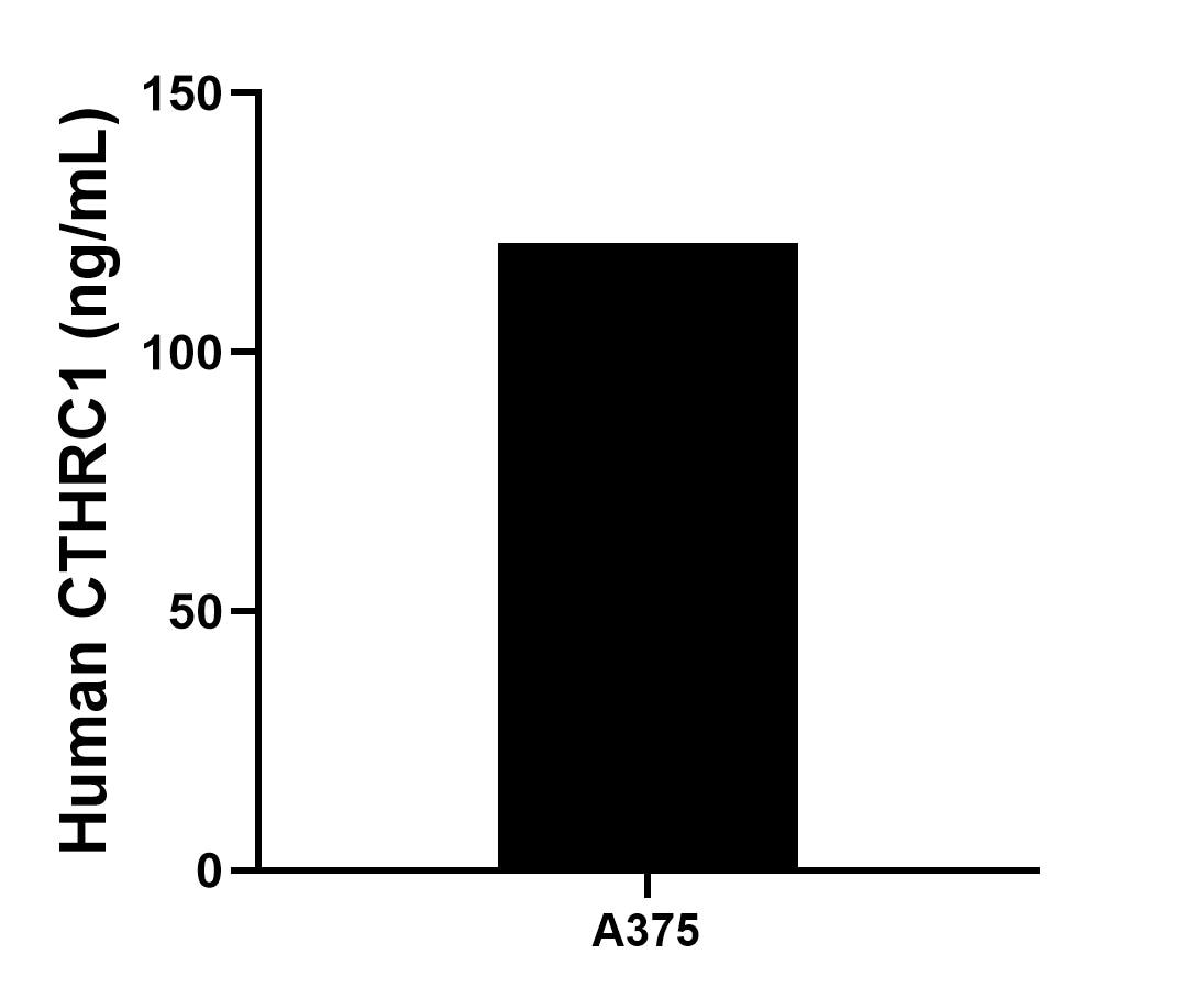 Sandwich ELISA sample test of MP02264-1 Sandwich ELISA sample test of MP02264-1