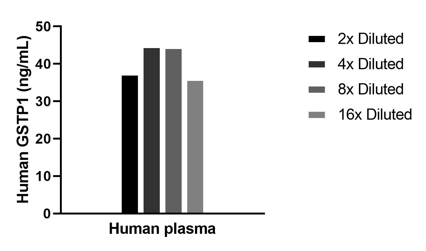 The mean GSTP1 concentration was determined to be 40.6 ng/mL in Human plasma. The mean GSTP1 concentration was determined to be 40.6 ng/mL in Human plasma.