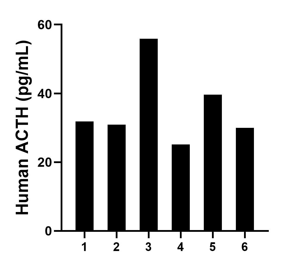 Plasma of six individual healthy human donors was measured. The ACTH concentration of detected samples was determined to be 35.6 pg/mL with a range of 25.1-55.9 pg/mL.	