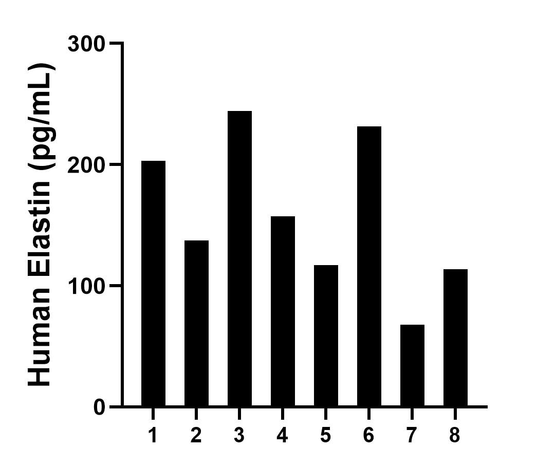 Serum of eight individual healthy human donors was measured. The Elastin concentration of detected samples was determined to be 159.0 pg/mL with a range of 67.9-244.2 pg/mL. Serum of eight individual healthy human donors was measured. The Elastin concentration of detected samples was determined to be 159.0 pg/mL with a range of 67.9-244.2 pg/mL.
