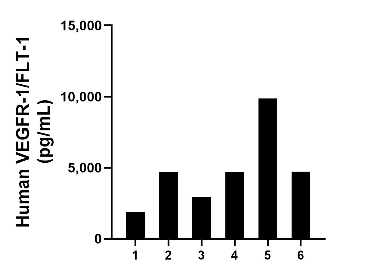 Saliva of six individual healthy human donors was measured. The human VEGFR-1/FLT-1 concentration of detected samples was determined to be 4,798.9 ppg/mL with a range of 1,871.9-9,859.6 pg/mL. Saliva of six individual healthy human donors was measured. The human VEGFR-1/FLT-1 concentration of detected samples was determined to be 4,798.9 ppg/mL with a range of 1,871.9-9,859.6 pg/mL.
