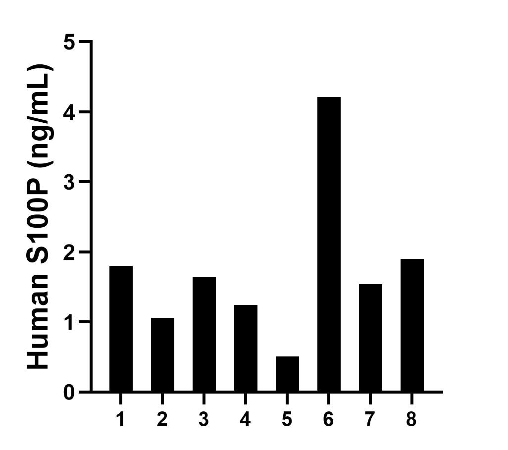 Serum of eight individual healthy human donors was measured. The S100P concentration of detected samples was determined to be 1.74 ng/mL with a range of 0.51-4.21 ng/mL. Serum of eight individual healthy human donors was measured. The S100P concentration of detected samples was determined to be 1.74 ng/mL with a range of 0.51-4.21 ng/mL.