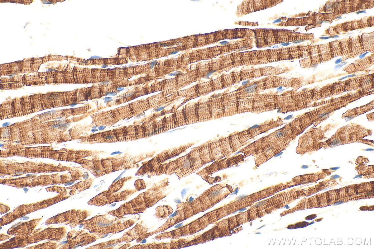 IHC staining of mouse heart using 33909-1-AP Immunohistochemistry (IHC) staining of mouse heart tissue using Sarcalumenin Polyclonal antibody (33909-1-AP)