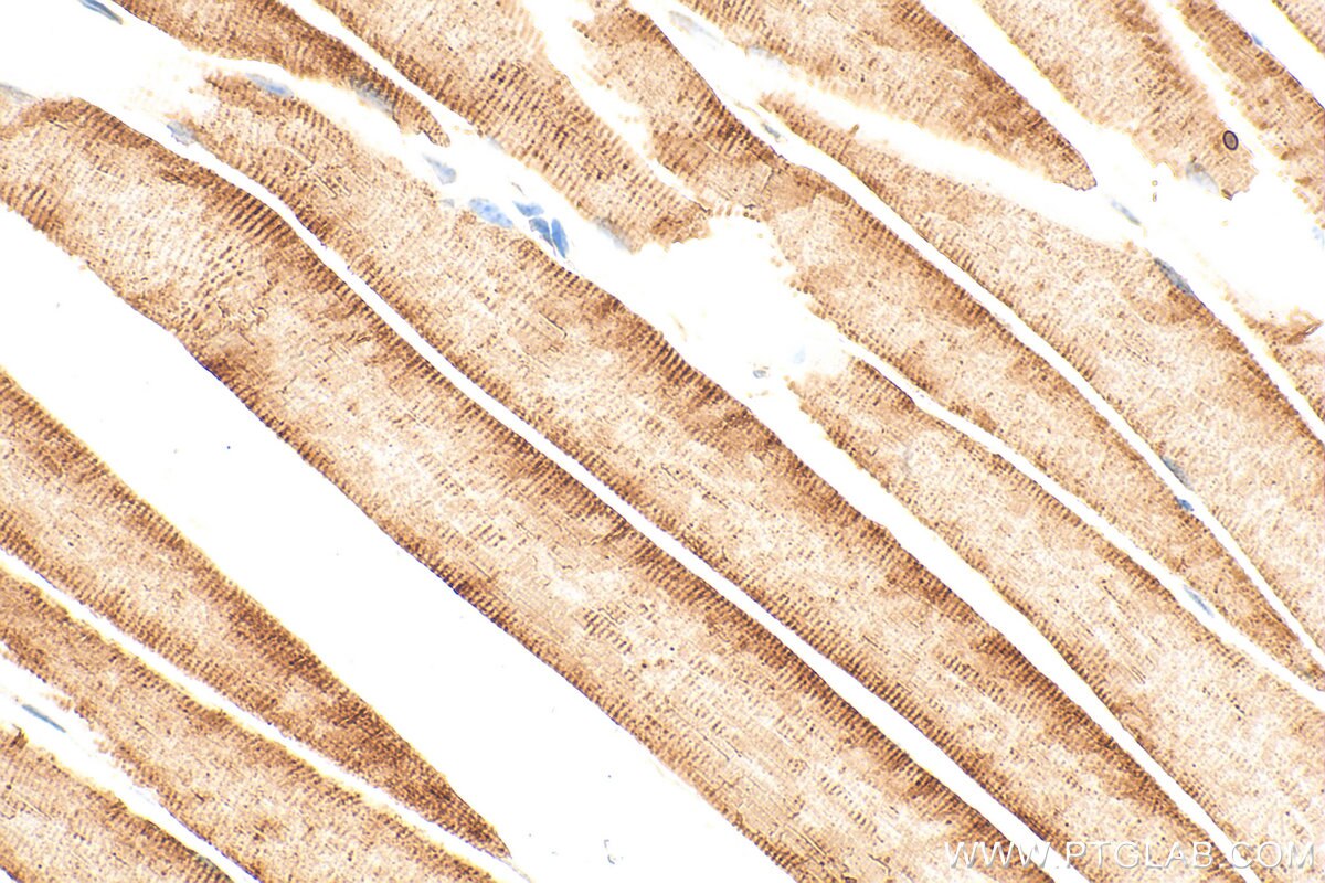 IHC staining of mouse skeletal muscle using 33909-1-AP Immunohistochemistry (IHC) staining of mouse skeletal muscle tissue using Sarcalumenin Polyclonal antibody (33909-1-AP)
