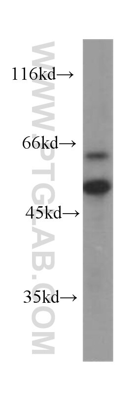 Western Blot (WB) analysis of MCF-7 cells using RISC Monoclonal antibody (60086-1-Ig)