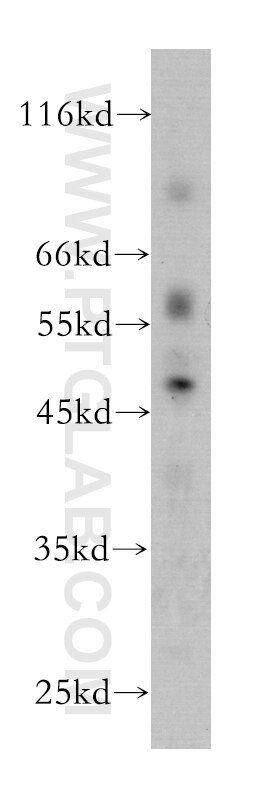 Western Blot (WB) analysis of human heart tissue using RISC Monoclonal antibody (60086-1-Ig)