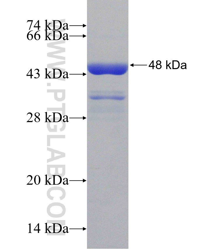 Scpep1 fusion protein Ag31457 SDS-PAGE