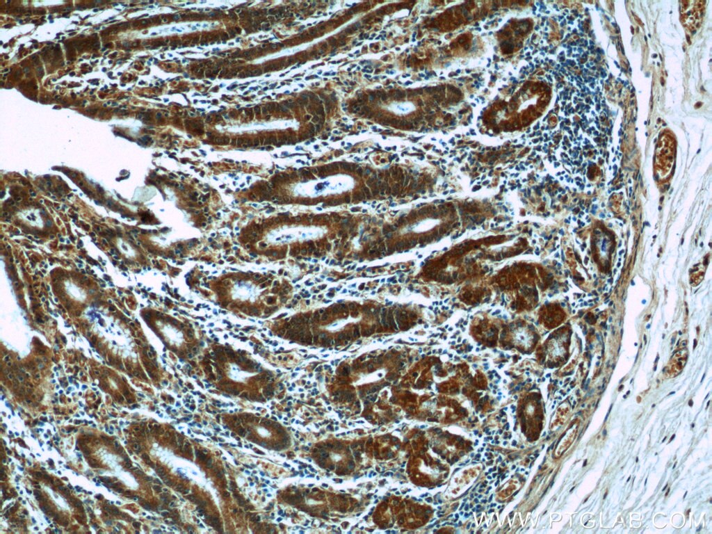 Immunohistochemistry (IHC) staining of human stomach tissue using SCT Polyclonal antibody (23125-1-AP)