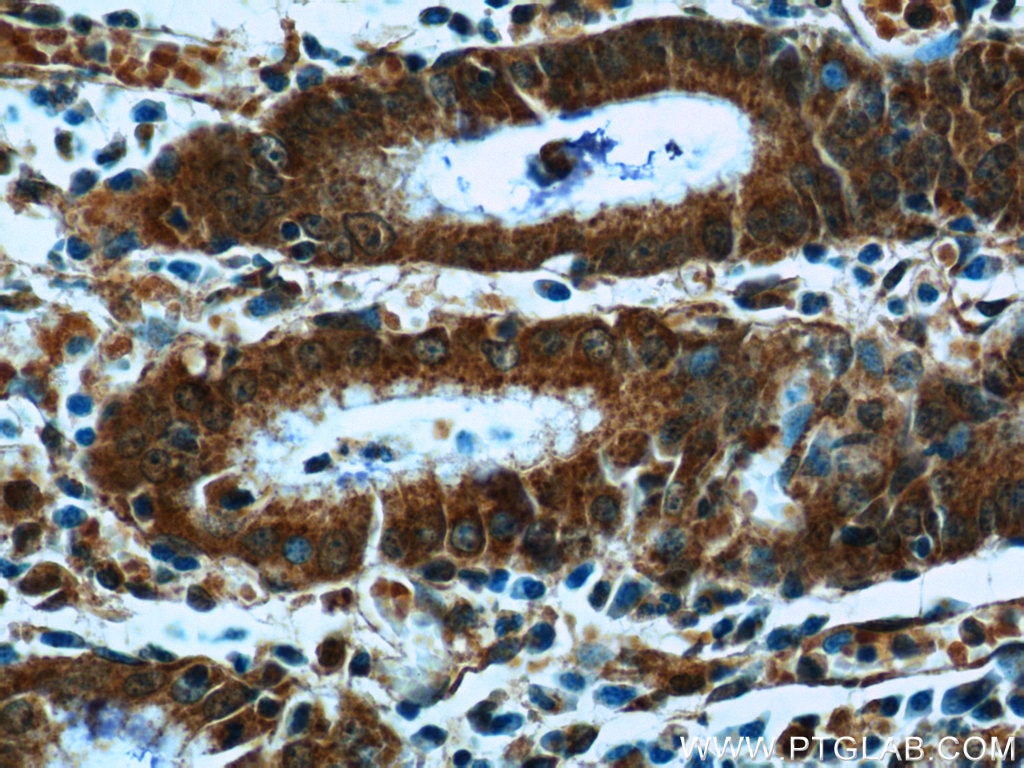 Immunohistochemistry (IHC) staining of human stomach tissue using SCT Polyclonal antibody (23125-1-AP)