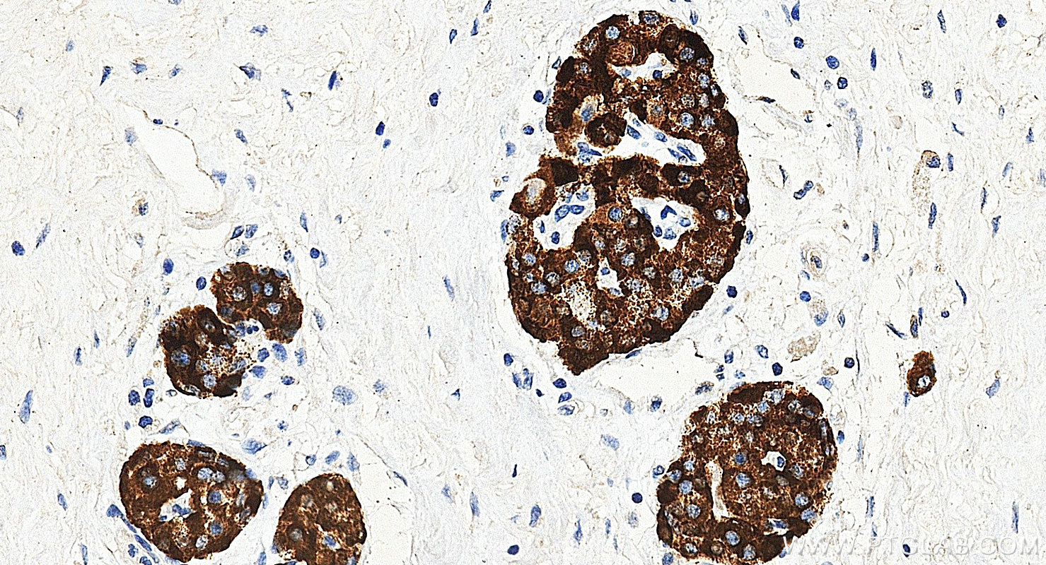 IHC staining of human pancreas using 67406-1-Ig Immunohistochemistry (IHC) staining of human pancreas tissue using Secretogranin V Monoclonal antibody (67406-1-Ig)