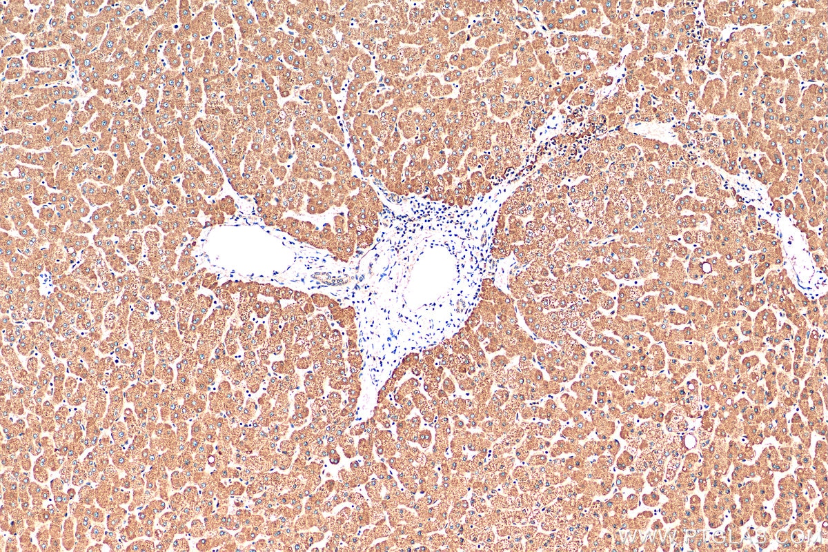 IHC staining of human liver using 30249-1-AP