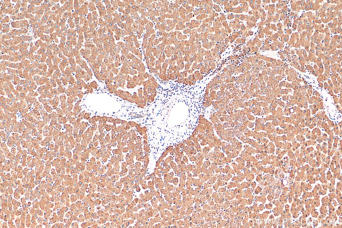 Immunohistochemistry (IHC) staining of human liver tissue using Selenoprotein P Polyclonal antibody (30249-1-AP)