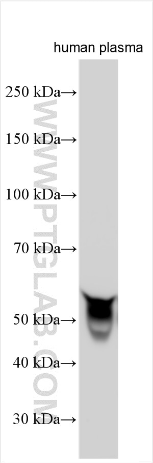 Western Blot (WB) analysis of human plasma using Selenoprotein P Polyclonal antibody (30249-1-AP)
