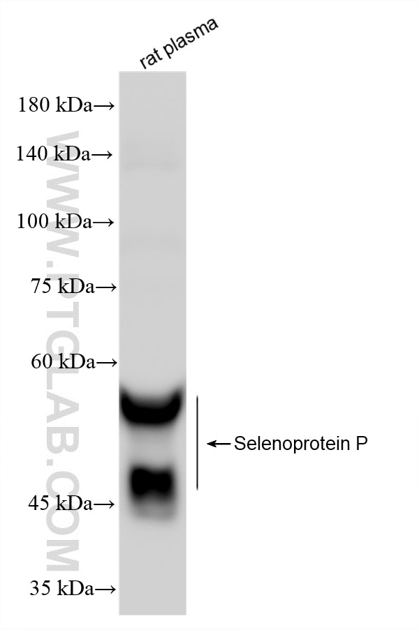Western Blot (WB) analysis of various lysates using Selenoprotein P Recombinant monoclonal antibody (85017-4-RR)