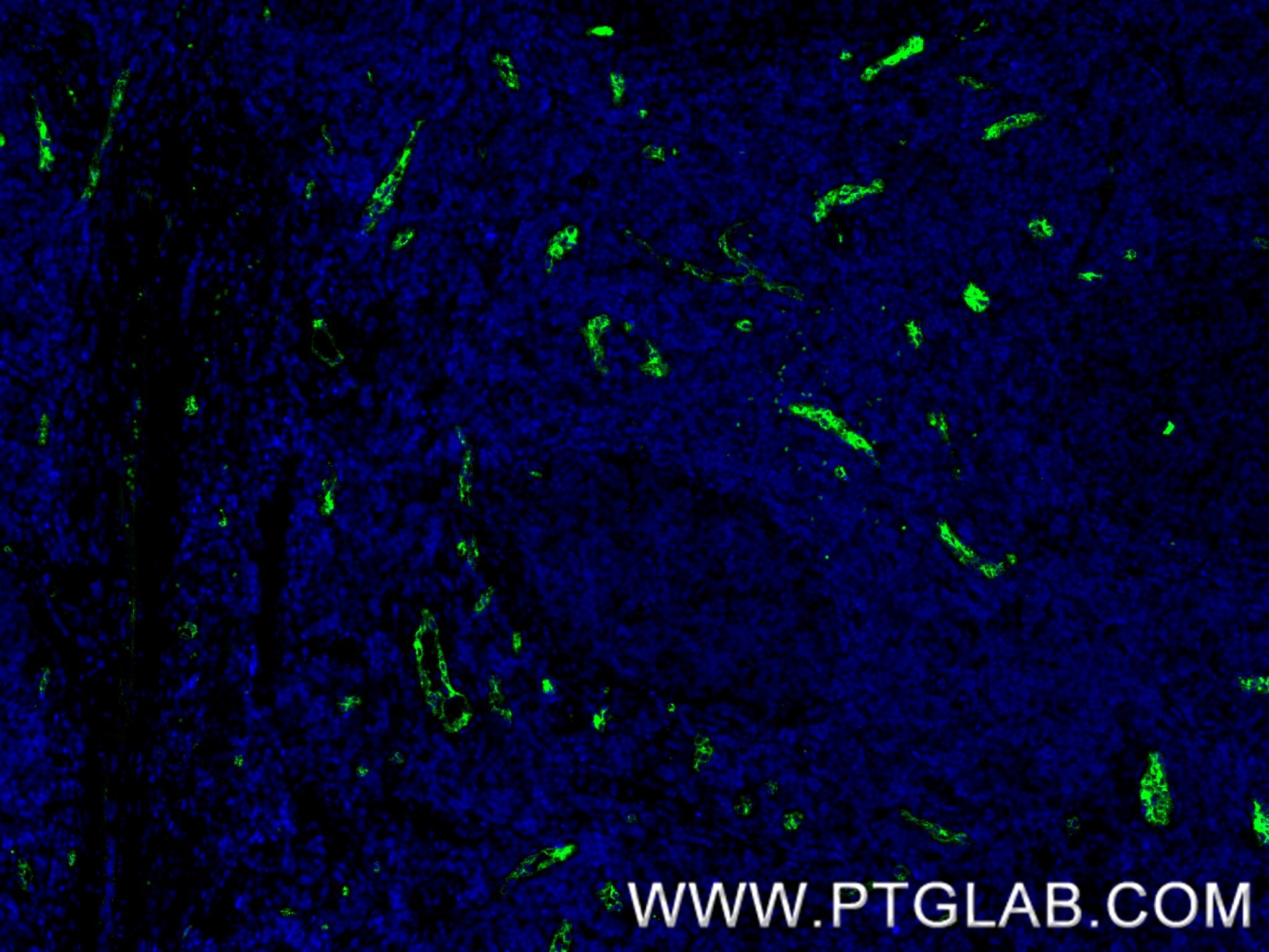 Immunofluorescence (IF) / fluorescent staining of human tonsillitis tissue using P-Selectin/CD62P Recombinant antibody (83947-5-RR)