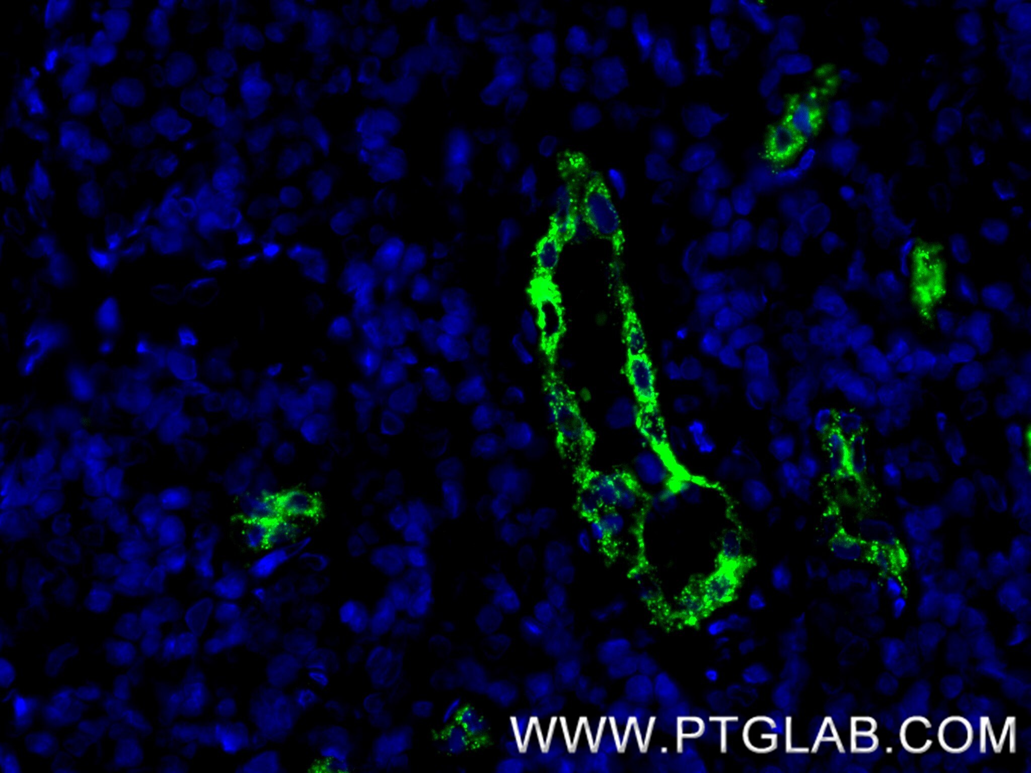 Immunofluorescence (IF) / fluorescent staining of human tonsillitis tissue using P-Selectin/CD62P Recombinant antibody (83947-5-RR)