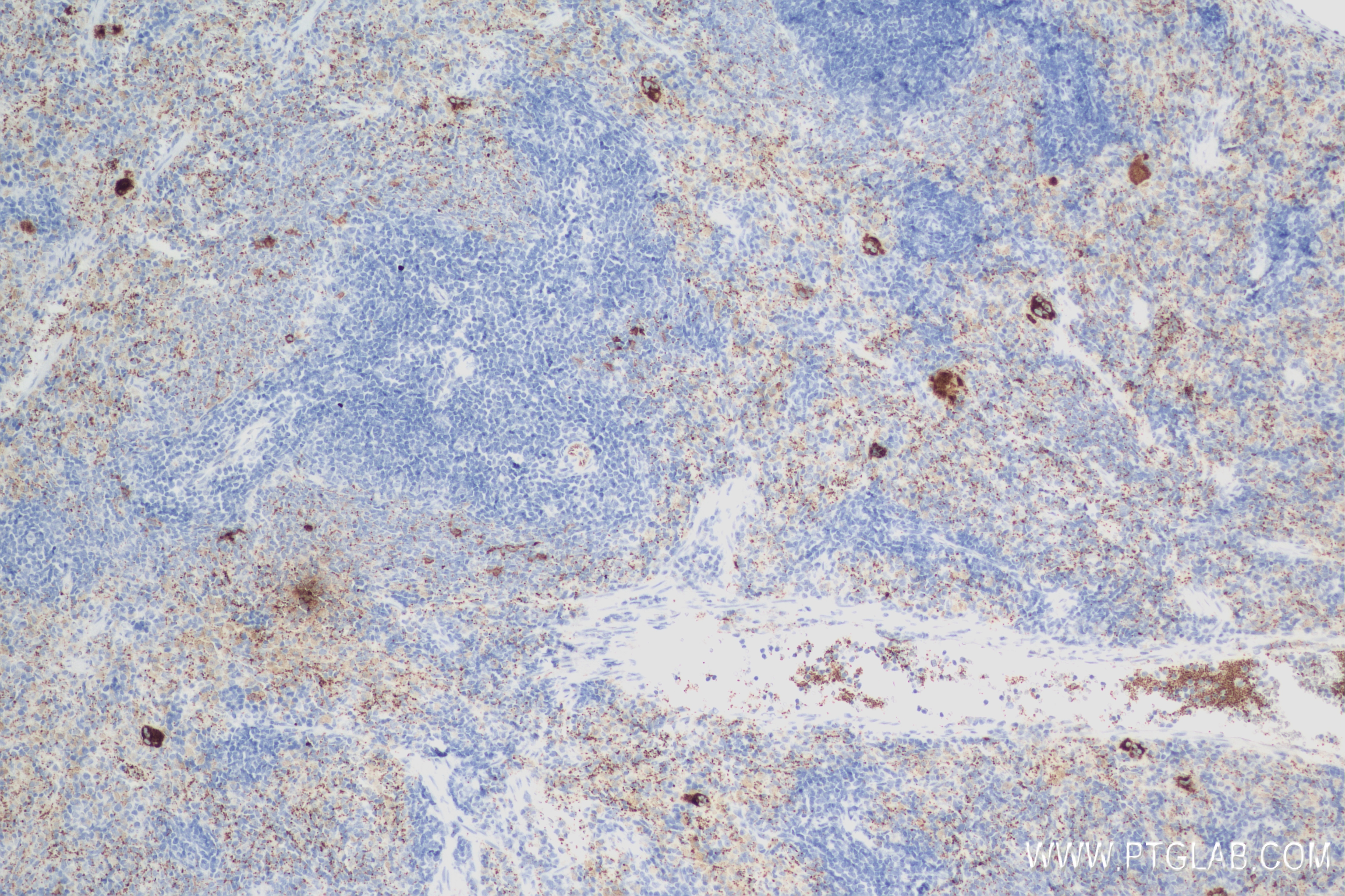 Immunohistochemistry (IHC) staining of rat spleen tissue using P-Selectin/CD62P Recombinant antibody (83947-5-RR)