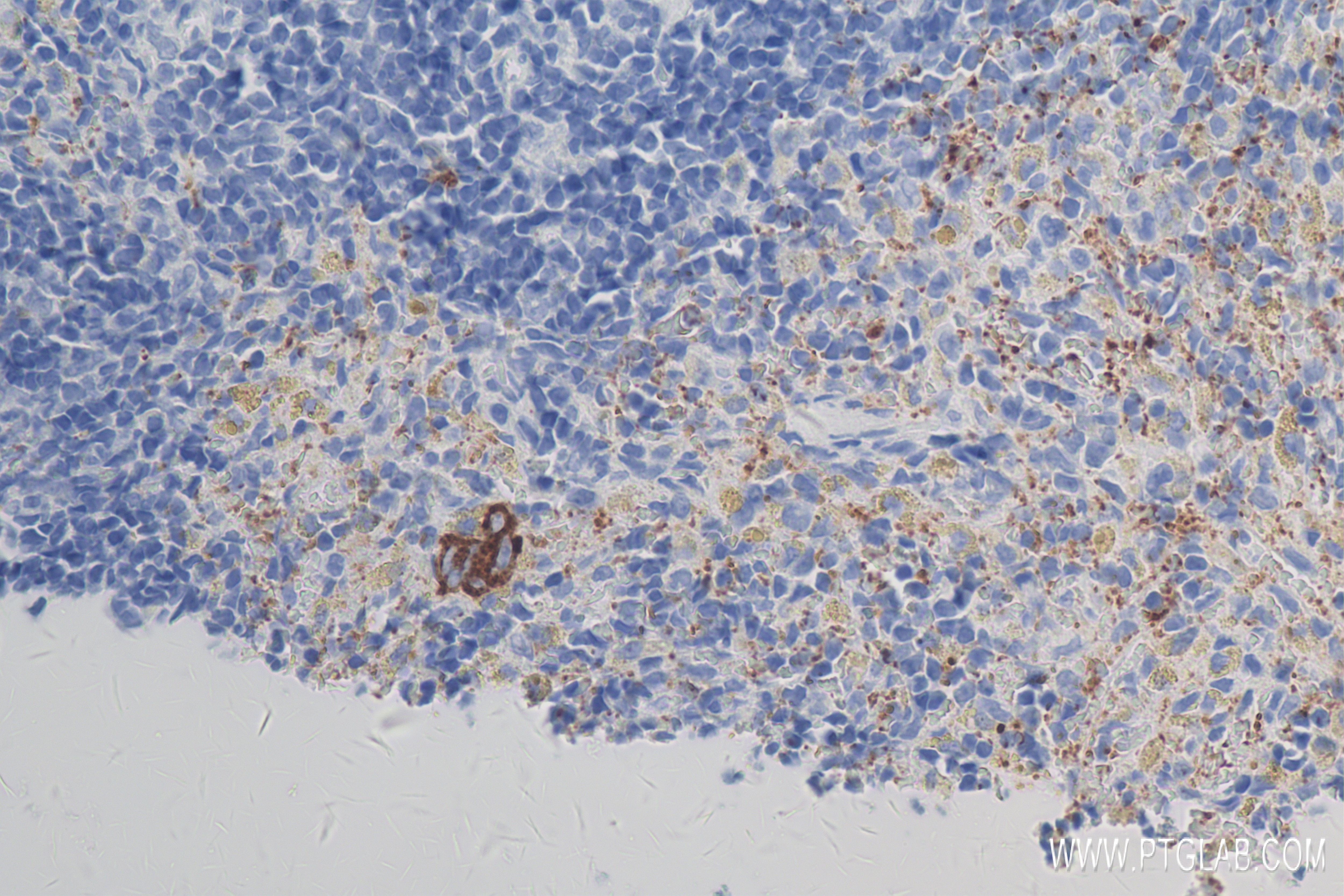 Immunohistochemistry (IHC) staining of rat spleen tissue using P-Selectin/CD62P Recombinant antibody (83947-5-RR)