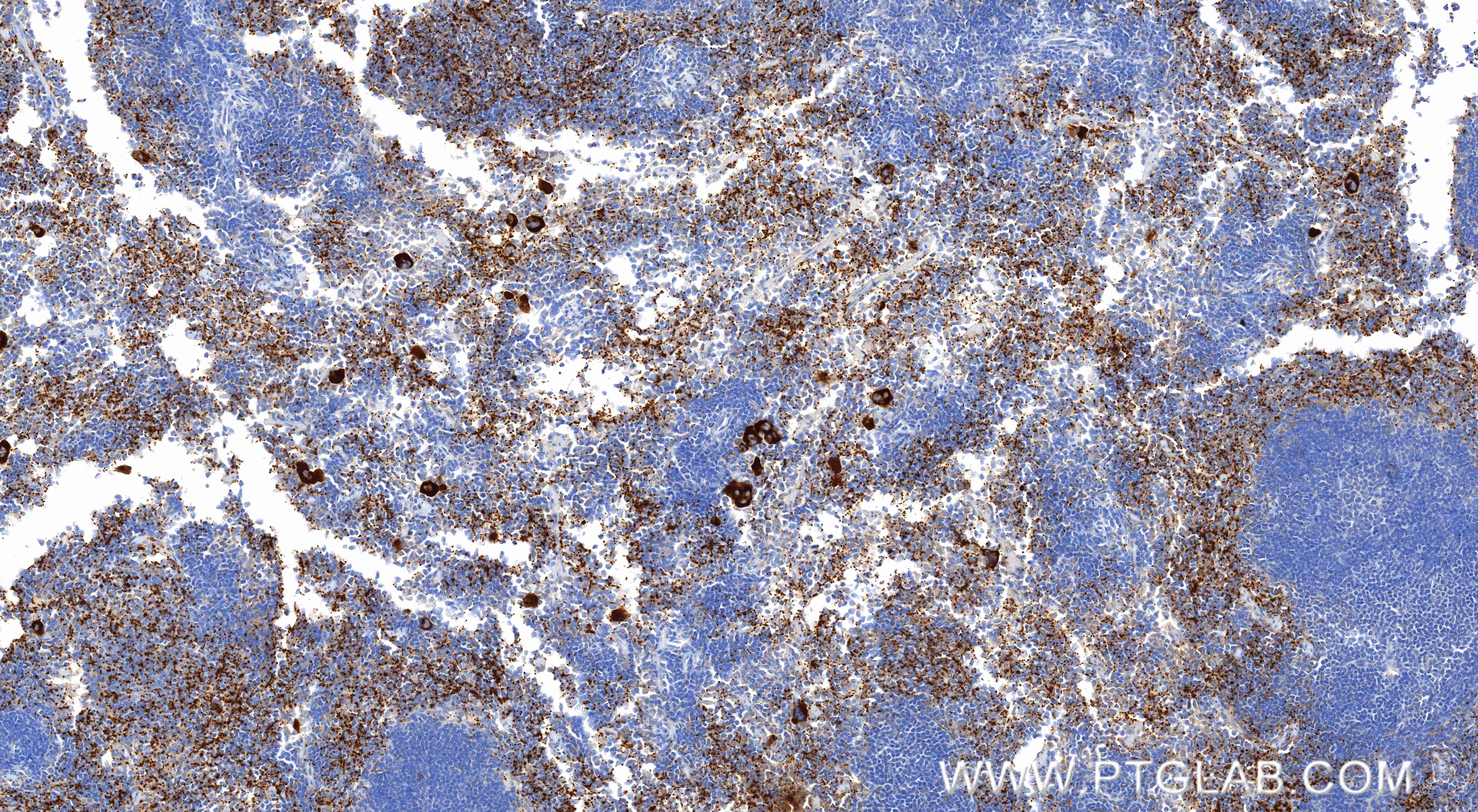 Immunohistochemical analysis of paraffin-embedded mouse spleen tissue slide using 83947-5-RR (P-Selectin/CD62P antibody) at dilution of 1:800 (under 10x lens). Heat mediated antigen retrieval with Tris-EDTA buffer (pH 9.0). Immunohistochemistry (IHC) staining of mouse spleen tissue using P-Selectin/CD62P Recombinant monoclonal antibody (83947-5-RR)